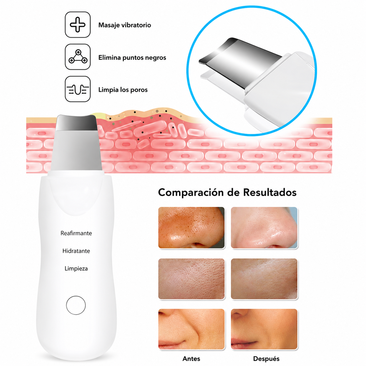 Depurador Facial Ultrasónico